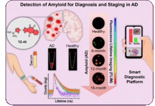 Indian Scientists Develop Low-Cost Technology for Alzheimer’s Detection